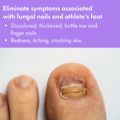 Vite 20 Brush-On Antifungal Solution 0.5oz Example 1