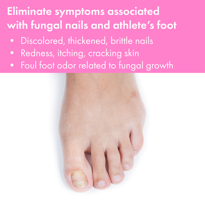 Vite 20 Antifungal Cream 0.54oz Example 1