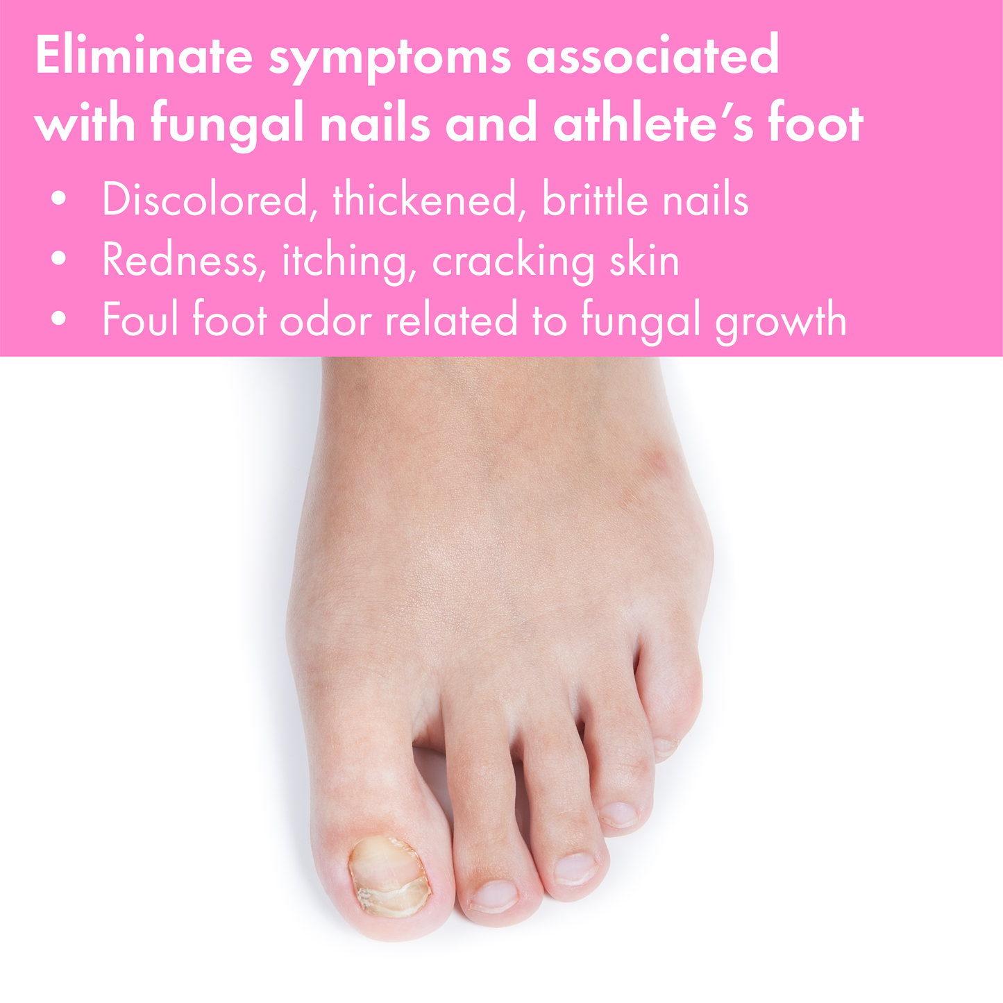 Vite20 Antifungal Cream 1oz