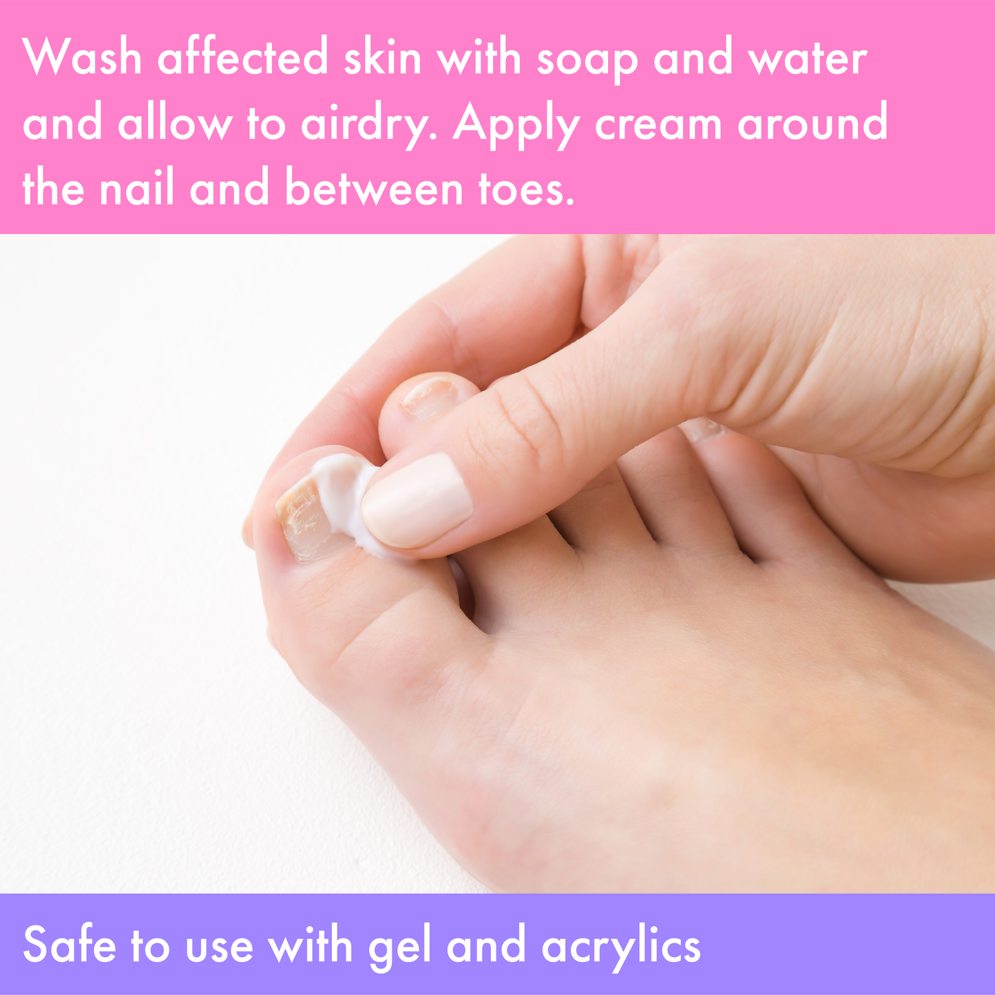 Vite20 Antifungal Cream 1oz