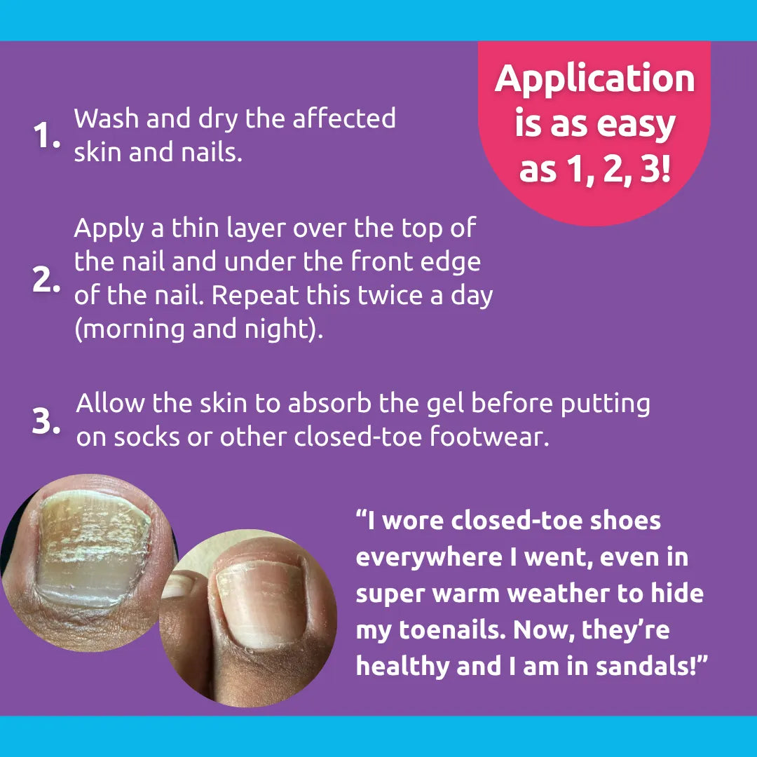 Vite20 Antifungal - Nail Serum example 1