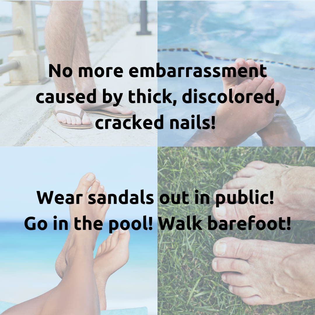 Vite20 Antifungal - Nail Serum sample 2